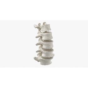3D model Real Human Lumbar Vertebrae L1 to L5 Bones 01 White